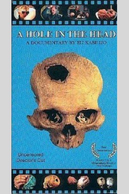 A Hole in the Head