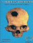 A Hole in the Head