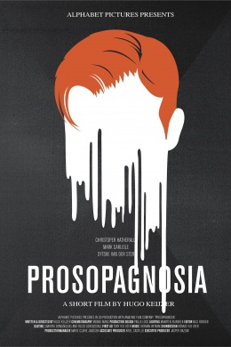 Prosopagnosia