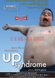 Up Syndrome